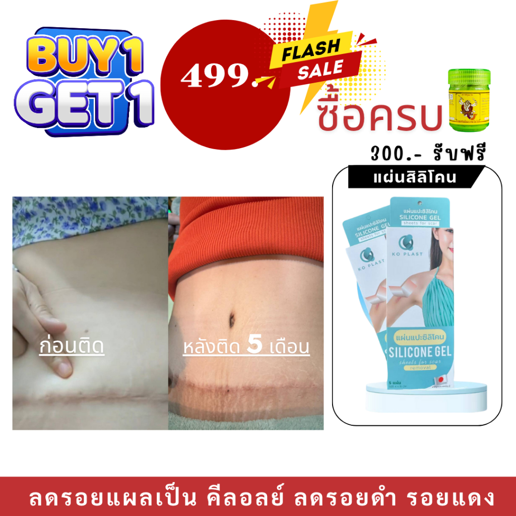 ส่งไว++ของแท้ มี อย.!!แผ่นซิลิโคนรอยแผลเป็น ตรา โคพลาสใน 1 กล่อง มี 5 แผ่น+แถมฟรีแผ่นแปะเข่า