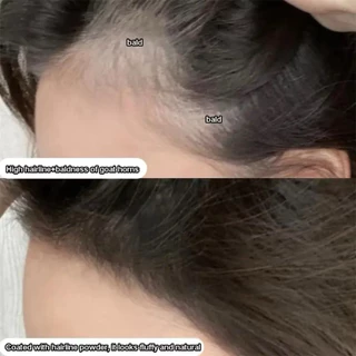 4GEGE BEAR มีเส้นผมที่หลุดออกมา การซ่อมแซมและฟิลเลอร์เส้นผม การซ่อมแซมเส้นผมและผงฟิลเลอร์