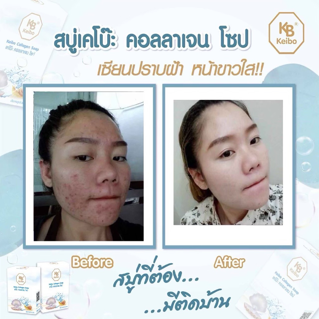 (พร้อมส่ง ) สบู่คอลลาเจนเคโบ๊ะ keibo ลดฝ้า กระ จุดด่างดำ หน้าหมองคล้ำ ขนาด 60 กรัม ( 1 ก้อน 55.-) - รูปที่ 6