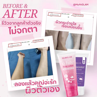 (เซต 3 หลอด) MythGLAM (โลชั่นมิธแกลม+บูสเตอร์มิธแกลม+มอยส์ครีมออยล์)
