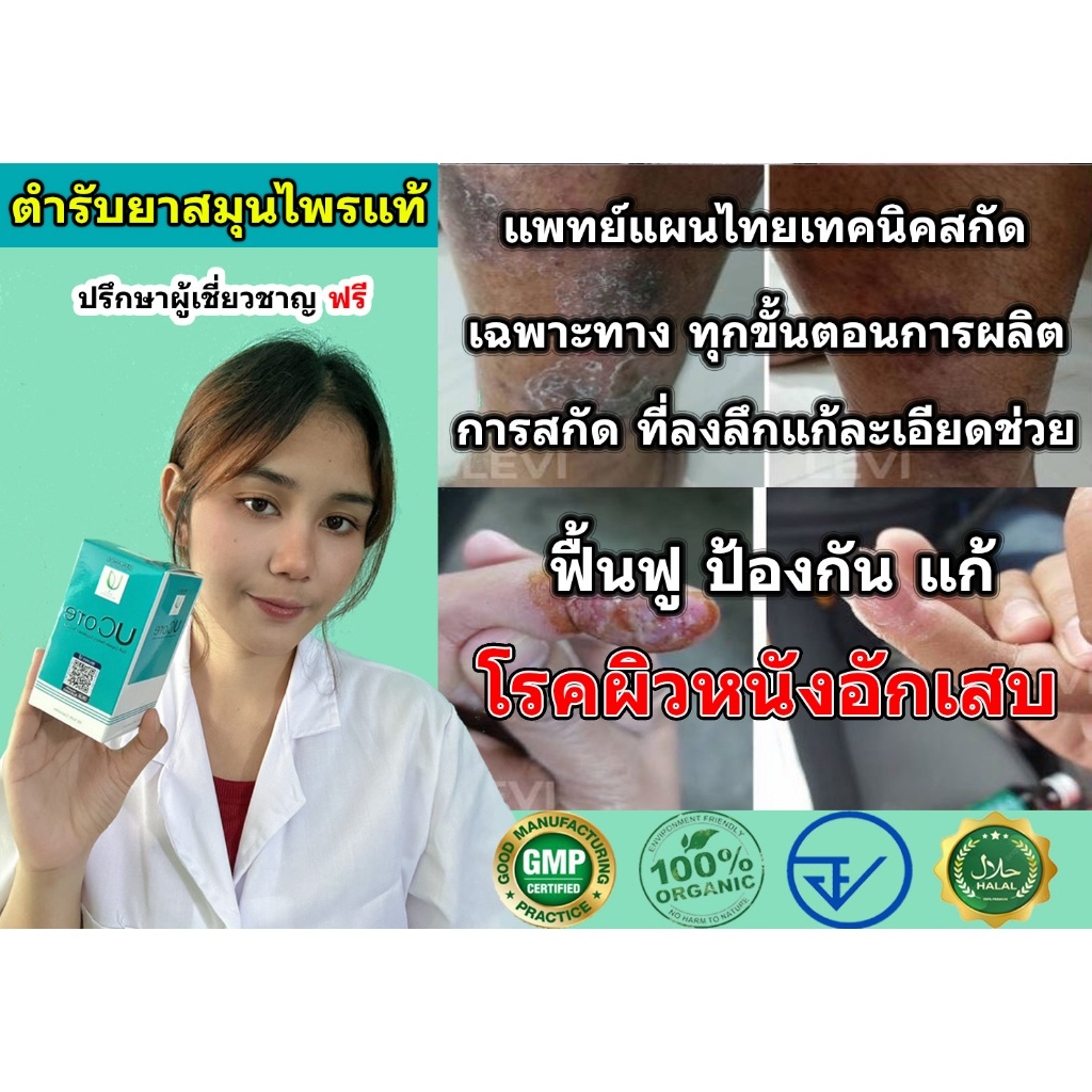 (ผิวหนังอักเสบ) ผลิตภัณเสริมอาหาร Balance Ucore ของแท้100% ส่งตรงจากบริษัทโดยตรง