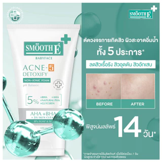 Smooth E Acne-5 Detoxify Non-Ionic Foam [50 ml. / 120 ml.] โฟมล้างหน้าลดสิว เสริมปราการผิวคุมมัน สิว