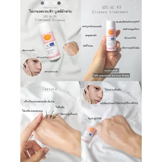 ❎EXP.02/27 | SOS VC X3 Treatment Essence เอะสึ โอ เอะสึ วีซี เอ็กซ์ 3 ทรีทเมนท์ เอสเซนส์ 170 มล.