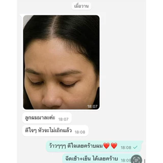 สเปรย์ฉีดผมหนาสูตรธรรมชาติ