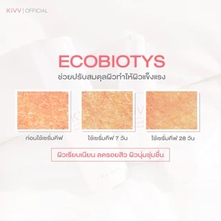 Kivv intensive serum มี 2 ขนาด 15ml. และ 30ml. เซรั่มคีฟ ลดสิว รอยสิว สำหรับผิวแพ้ง่าย