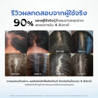 [Bundle set ลดเพิ่ม40บาท] KEBOU 8X DEFENSE เวชสำอางลดผมขาดหลุดร่วง รังแคและอาการคันในขั้นตอนเดียว