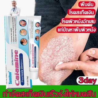 ครีมแก้คัน ครีมลดอาการคัน สะเก็ดเงินครีม โรคผิวหนัง เกลื้อน กลาก คัน สมุนไพร แก้คันเรื้อรัง คันในร่มผ้า