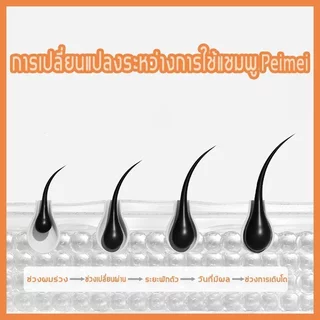 ซื้อ 1 แถม 1สินค้านำเข้าPEIMEI แชมพูแก้ผมร่วง แชมพูสมุนไพรขิงบำรุงผม250ml แชมพูปลูกผม ยาสระผมแก้ร่วง แชมพูขิงเพียว แชมพู