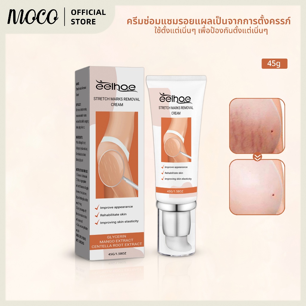 ครีมรอยแตกลาย ลดรอยแตกลาย ครีมทาขาแตกลาย ทา7วันหาย ครีมทาหน้าท้อง ครีมซ่อมแซมรอยแผลเป็น