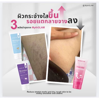 (เซต 3 หลอด) MythGLAM (โลชั่นมิธแกลม+บูสเตอร์มิธแกลม+มอยส์ครีมออยล์)