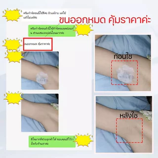 ครีมขจัดขนน้องสาว กำจัดขน แว็กขน กำจัดขนรักแร้ กำจัดขนที่ลับ อ่อนโยนต่อผิว ไม่เหลือตอ กำจัดขนจุดซ่อนเร้นถาวร น้องสาวเนี