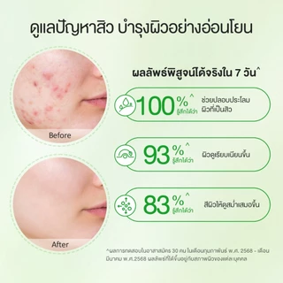 Glad2Glow Centella Gel Moisturizer (ครีมมอยเจอไรเซอร์สำหรับผิวหน้า) ความชุ่มชื้น ใบหน้า เจล Skincare 100กรัม