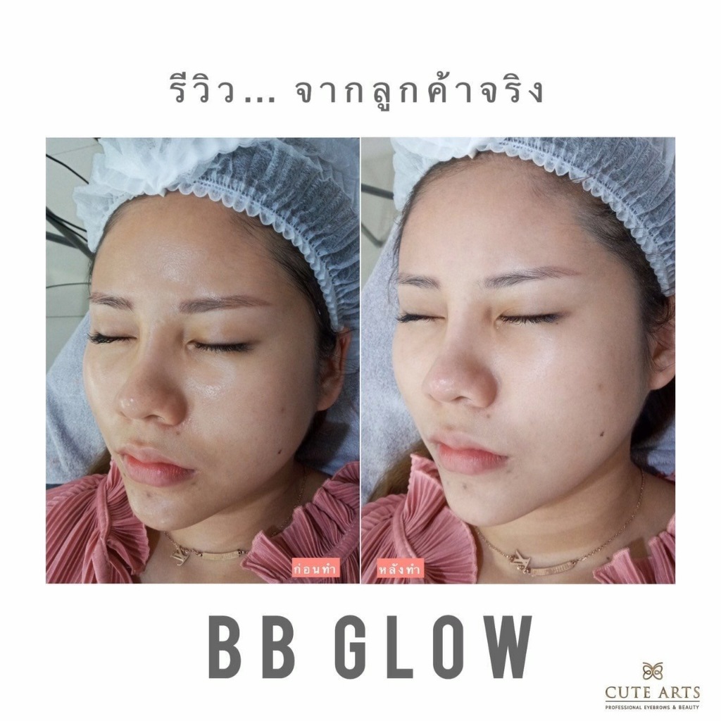 รูปภาพ 2