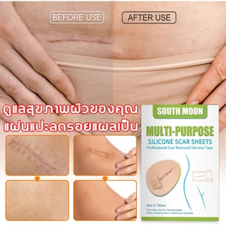 【จัดส่งจากกรุงเทพฯ】South Moon รักษารอยแผลเป็น แผ่นแปะแผลเป็น 4cm*150cm กําจัดรอยแผลเป็นจากแผลเป็น เผยผิวเนียนสวย
