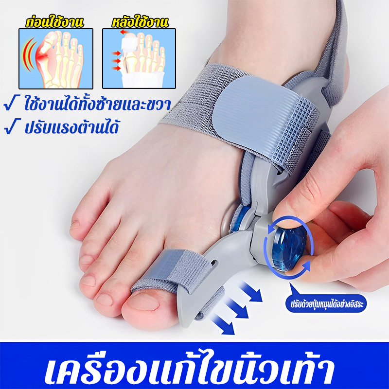 เครื่องแก้ไขนิ้วเท้า ที่คั่นนิ้วเท้า