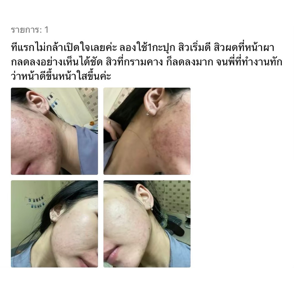 ครีมATK ของแท้  ( แพ็คเกจใหม่สูตรเดิม ) ราคา ถูกที่สุด ดีลบีเคเค แกลเลอรีภาพที่ 7