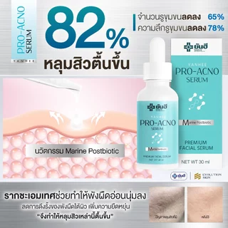 ยันฮี โปร-เอกโน่ Yanhee Pro Acno Serum เซรั่มลดสิวเวชสำอาง หลุมสิว รอยสิว สูตรอ่อนโยน