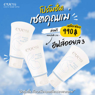 ใหม่!! EVES อีฟส์ อีฟส์ออยล์ อีฟส์ แอนตี้ สเตรช มาร์ค บอดี้ …