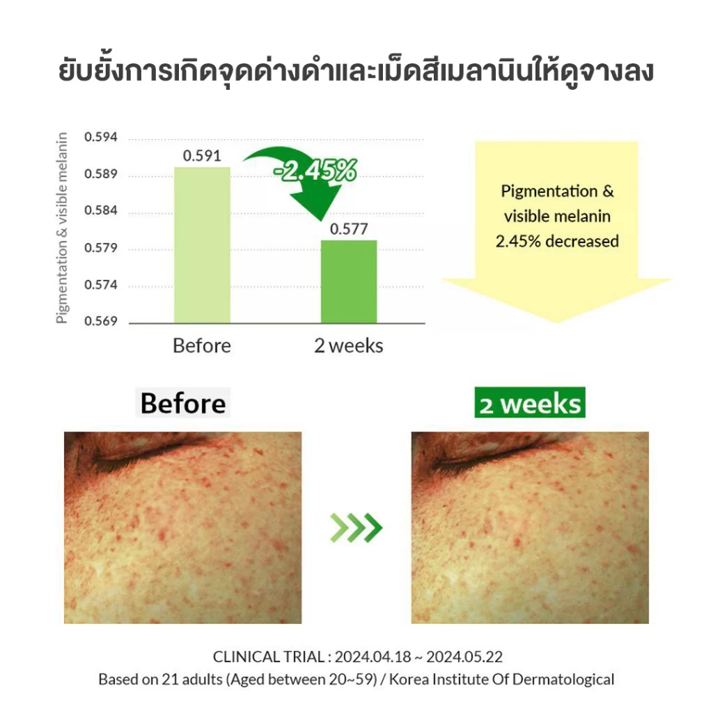 DR.ALTHEA GENTLE VITAMIN C SERUM  เซรั่มวิตามินซีสูตรอ่อนโยน (Fungal Acne Save) ดร.อัลเทีย thumbnail 7