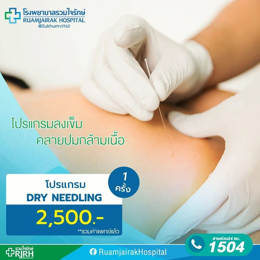 โปรแกรมลงเข็มคลายปมกล้ามเนื้อ (DRY NEEDLING) รวมใจรักษ์