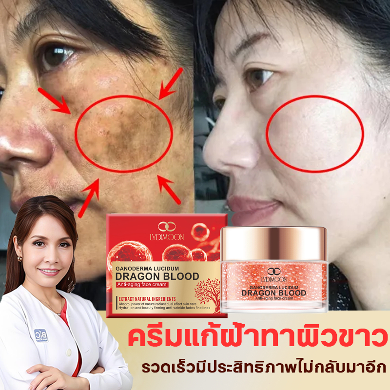 ครีมหน้าใส ทาผิวขาว ครีมทาฝ้า 50g ลดริ้วรอย ชุ่มชื้น สดใส ฟื้นฟูผิว เหมาะกับผิวแพ้ง่าย รักษาฝ้า