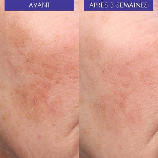 SO'BiO etic Lumilys C Brightening Correcting Serum Anti-dark spot ลดจุดด่างดำ ผิวสว่างกระจ่างใส — صورة 3