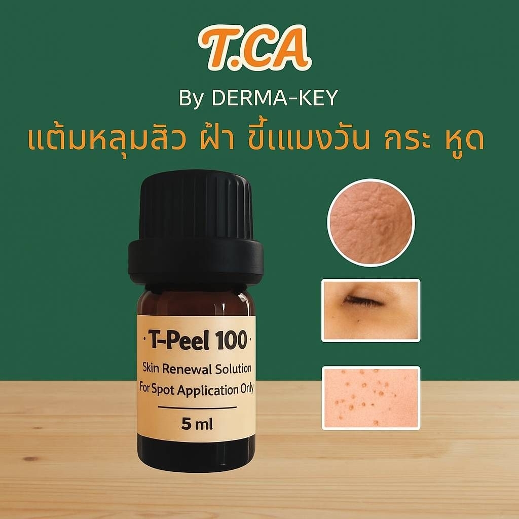 T-Peel 100% สำหรับหลุมสิว หูด ขี้แมงวัน ติ่งเนื้อ