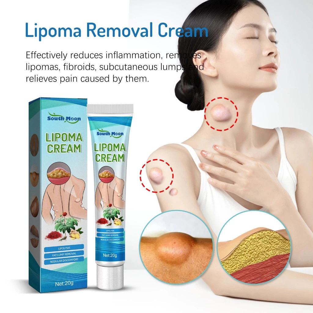 ครีม Lipoma กำจัด Lipoma สมุนไพรธรรมชาติครีมนวดกำจัดก้อนไขมัน - รูปที่ 2