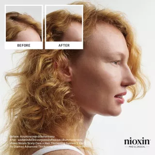 NIOXIN System 4 Shampoo สำหรับผมบางชัดเจน ผมทำสี/ดัด-ยืด/ฟอก 300ml (ไนอ๊อกซิน แชมพูลดผมขาดหลุดร่วง ปกป้องสีผม)