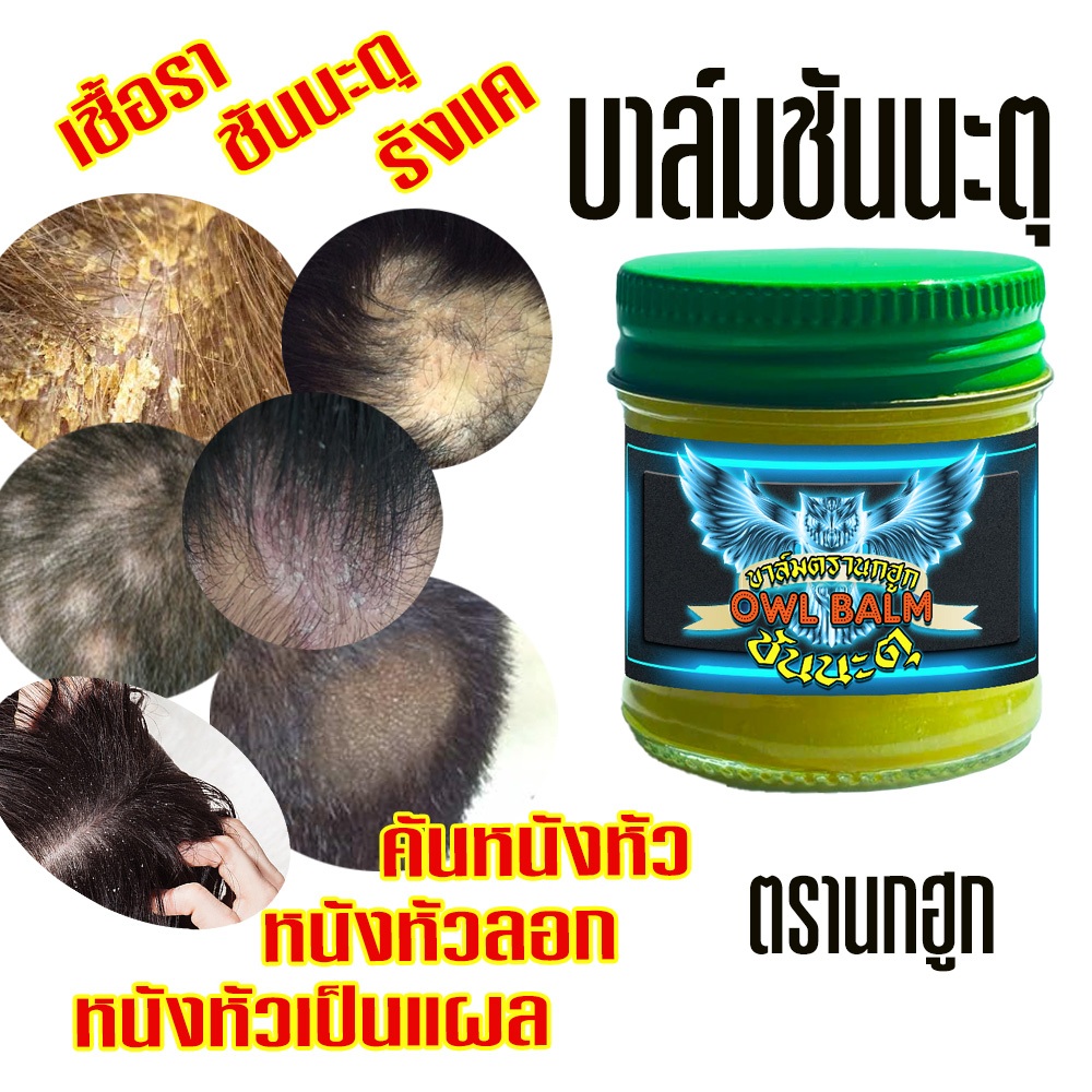 ลาก่อนนะจ้ะ ชันนะตุหนังหัวลอกคันแสบ มีขุยตุ่มผื่นแดงคันแสบหัวหนังศรีษะ