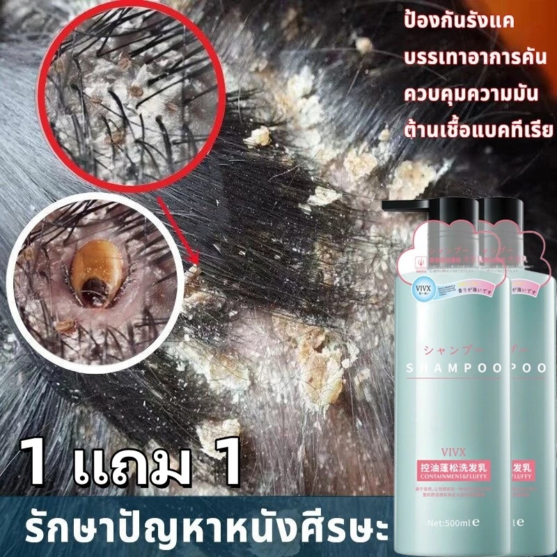 【1 แถม 1】แชมพูรังแค แชมพูคัน แชมพูยาเชื้อรา 500ml แชมพูแก้คันหนังศรีษะ ขจัดรังแค หยุดอาการคัน ลดผมร่วง ยาสระผมขจัด