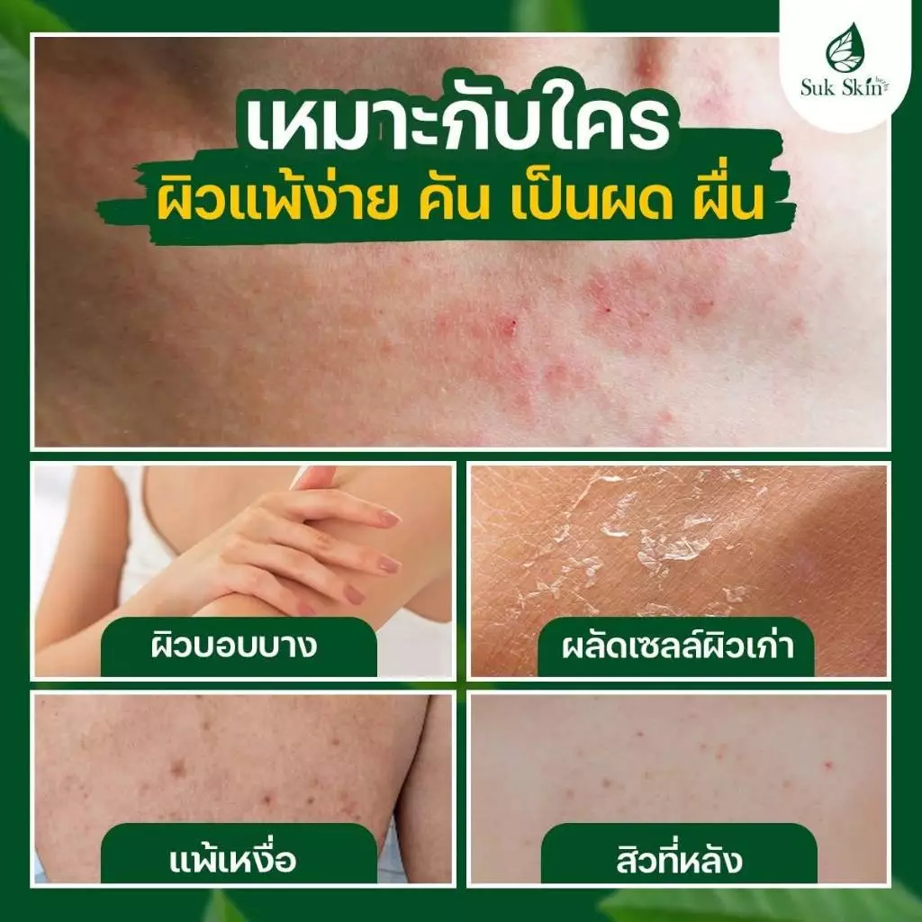 (20 กรัม) Suk Skin สบู่ สบู่สมุนไพร สบู่ผิวขาว สบู่สมุนไพรแก้คัน สบู่ลดสิว สบู่สมุนไพรเย็น สบู่สมุนไพรสุขสกิน thumbnail 5