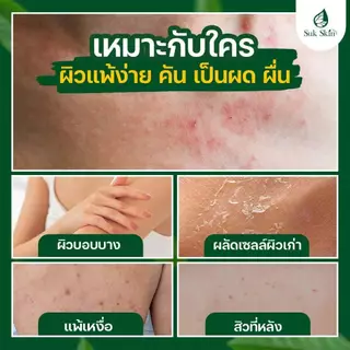 (20 กรัม) Suk Skin สบู่ สบู่สมุนไพร สบู่ผิวขาว สบู่สมุนไพรแก้คัน สบู่ลดสิว สบู่สมุนไพรเย็น สบู่สมุนไพรสุขสกิน