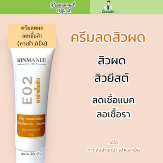 E02 ครีมทารักษาสิวผด สิวยีสต์ สิวผดร้อน ผิวติดสาร สูตรคลินิก สูตรพี่หมอนัท ป้องกันสิวผด รักษาสิวยีส คนเป็นสิว ผิวแพ้ง่าย