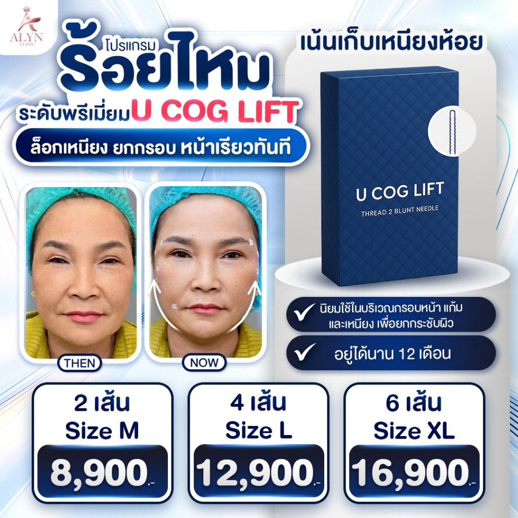 ร้อยไหมระดับพรีเมียม U COG LIFT ล็อกเหนียง ยกกรอบ หน้าเรียวทันที Alyn clinic