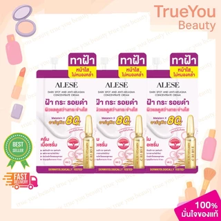 (3ซอง)ALESE Dark Spot and Anti Melasma Cream อะลิเซ่ ครีมเนื้อเซรั่มทาฝ้า สูตรเข้มข้น