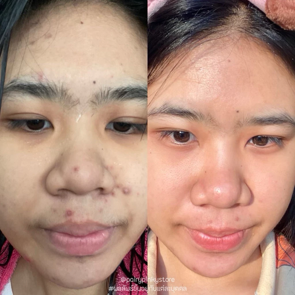 (พร้อมส่ง✅พาร์ทเนอร์บริษัท) สมุนไพรกาญจนา สมุนไพรไทย มาร์กสมุนไพร มาส์กสมุนไพร thumbnail 7