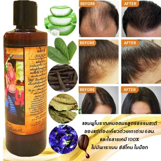 หมออมรแชมพูโบราณจากธรรมชาติ