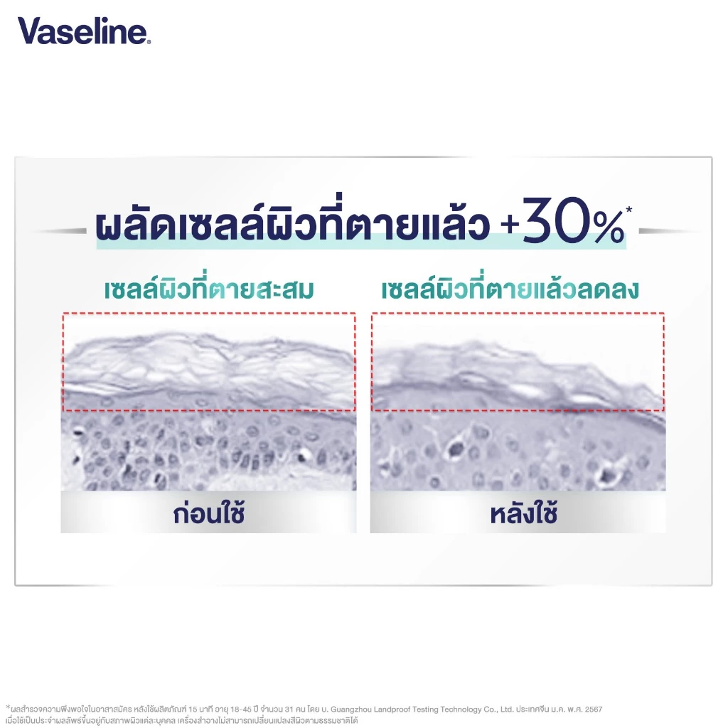 [อยู่ระหว่างเปลี่ยนบรรจุภัณฑ์] วาสลีน โปร เดอร์มา โลชั่น บอดี้แอมพูล 465มล. Vaseline Proderma Body Lotion 465ml thumbnail 10