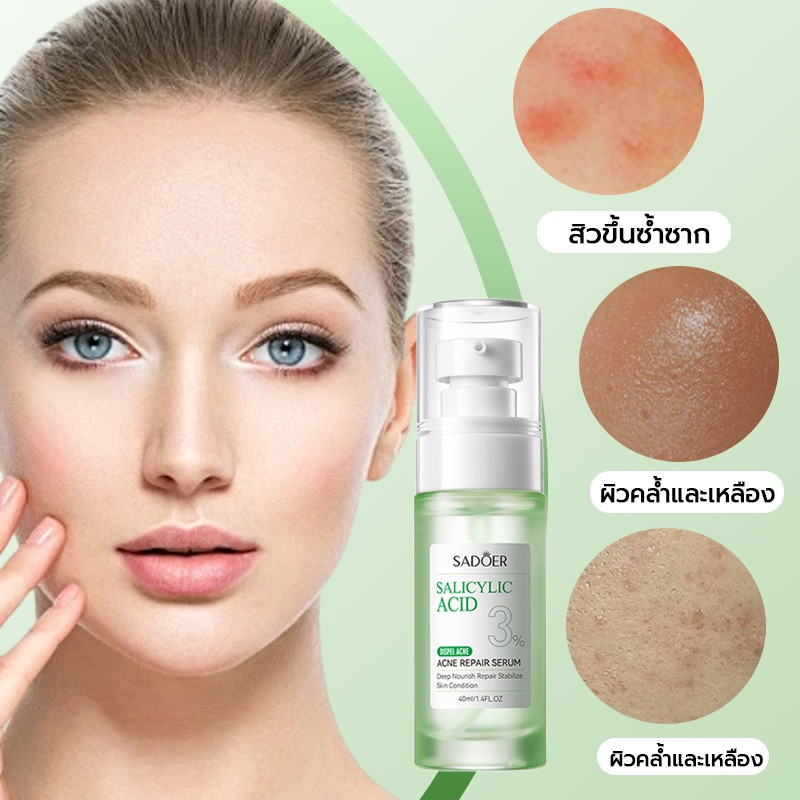 เอสเซ้นส์กรดซาลิไซลิก, SADOER, สกินแคร์อย่างอ่อนโยน, สำหรับรอยสิวและรอยแผลเป็นจากสิว, 30ml, กรดซาลิไซลิก 3% ราคา ถูกที่สุด ดีลบีเคเค แกลเลอรีภาพที่ 4