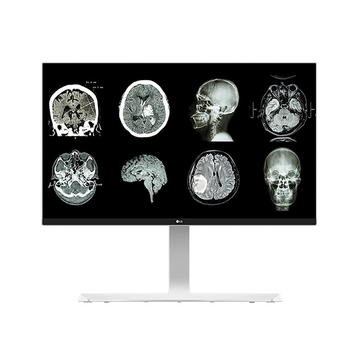 LG Monitor Clinical Review Monitor 27HJ712C-W 27" 8MP IPS 3840x2160 UHD จอทางการแพทย์ DICOM | จอ PAC
