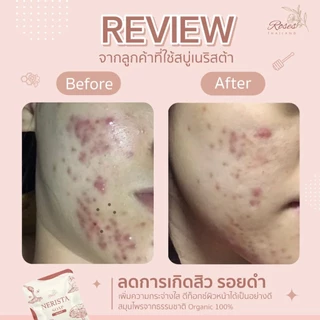 [แพ็กเกจจริง] มาส์กเนริสต้า Mask Nerista ขนาด 10 กรัม