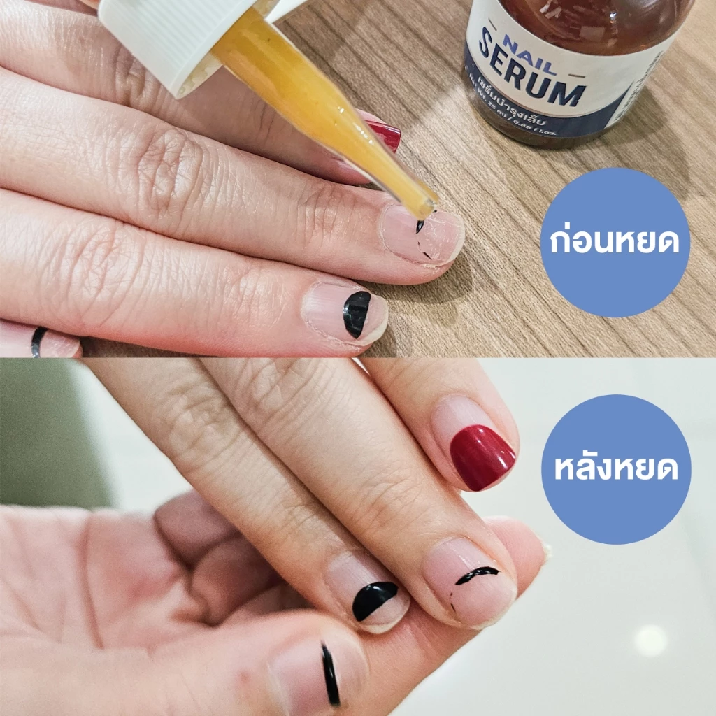 Cosma Nail Serum เซรั่มบำรุงเล็บ ลดเล็บขบ เชื้อรา thumbnail 9