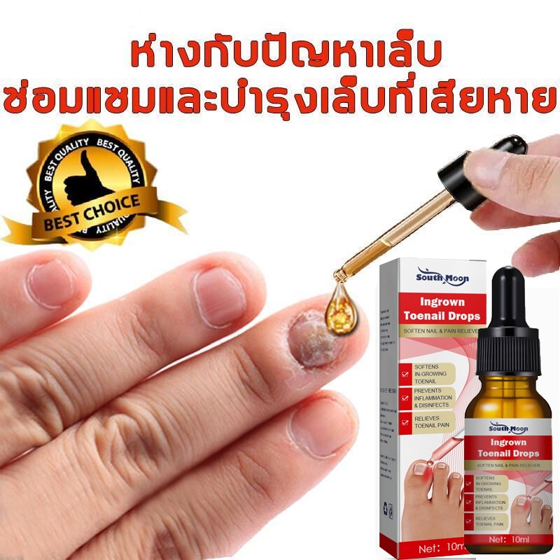 เซรั่มบำรุงเล็บ เชื้อราเล็บมือ บำรุงเล็บ ลากับเล็บเสีย ไม่ทำร้ายเล็บดี ห่างกับปัญหาเล็บ ซ่อมแซมเล็บ