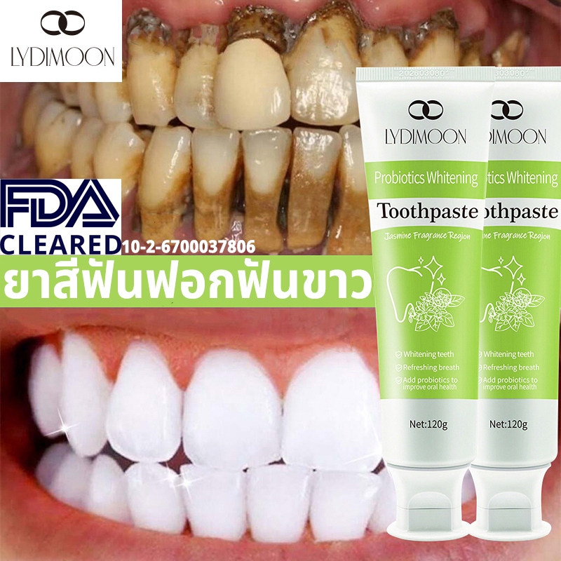 LYDIMOON ยาสีฟันฟอกฟันขาว ยาสีฟันฟันขาว ยาสีฟันโปรไบโอติก 120g ขจัดคราบเหลือง ฟอกสีฟัน ขจัดคราบพลัค 