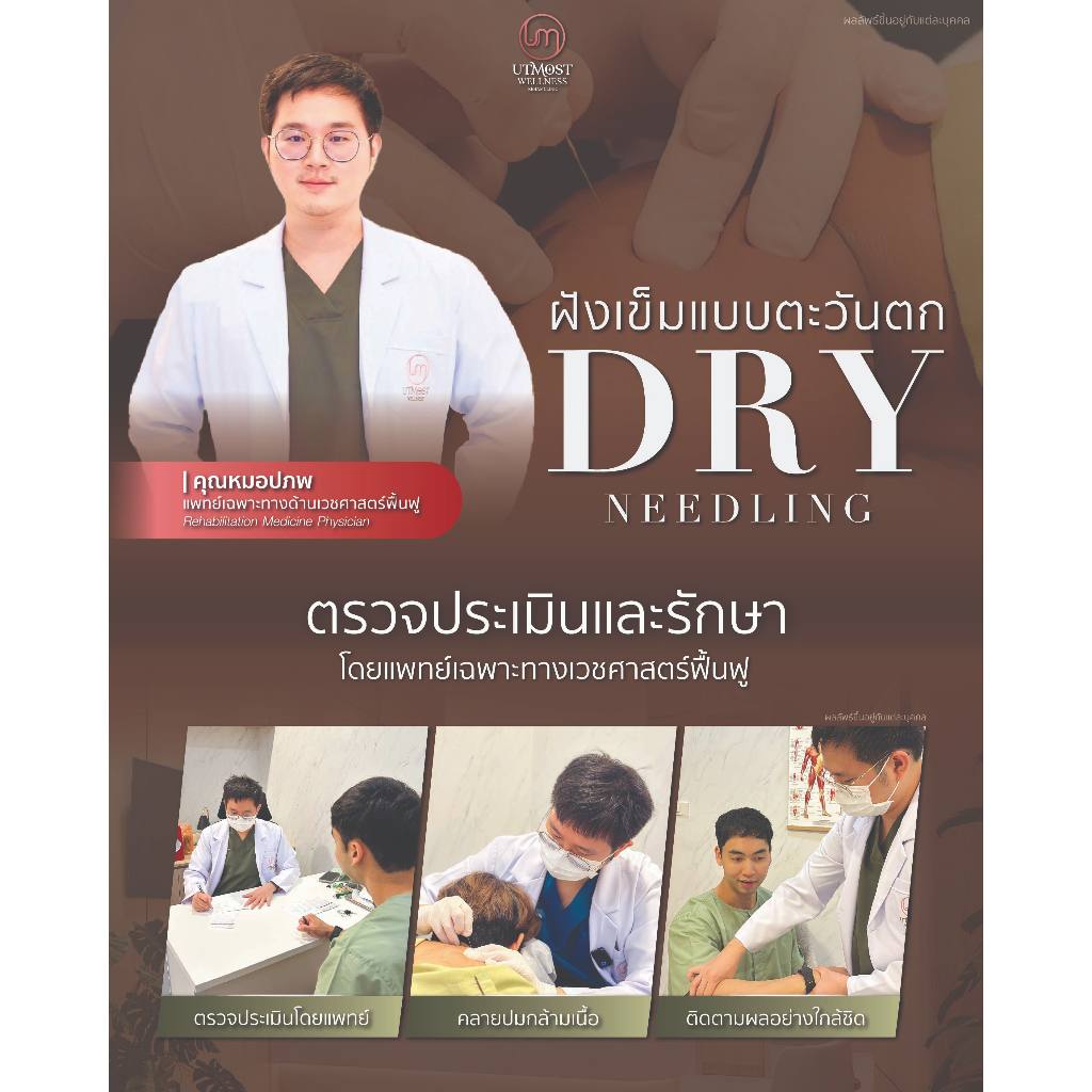 [E-coupon] ฝังเข็มตะวันตก Dry Needling