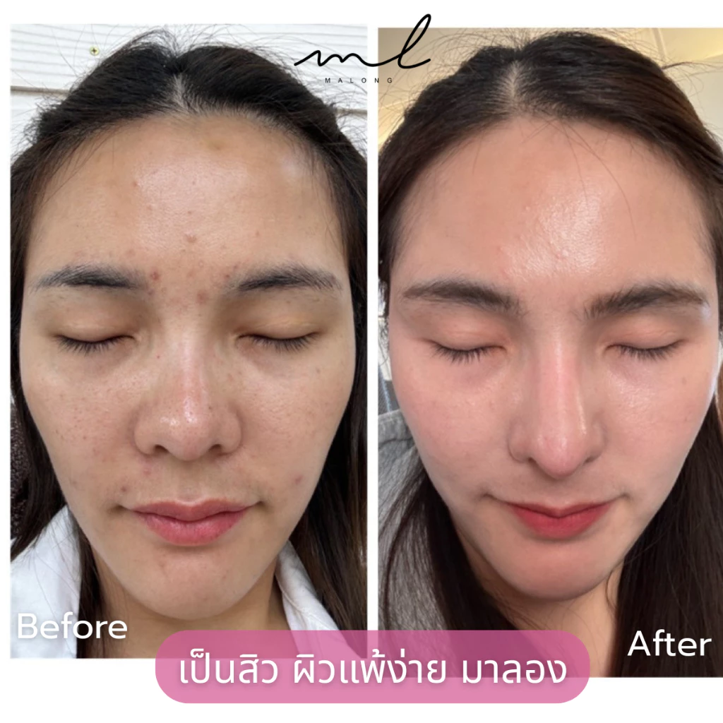 MALONGBELL เซรั่มวิตามินว่านรางจืด 15g (เดย์ครีม) thumbnail 7