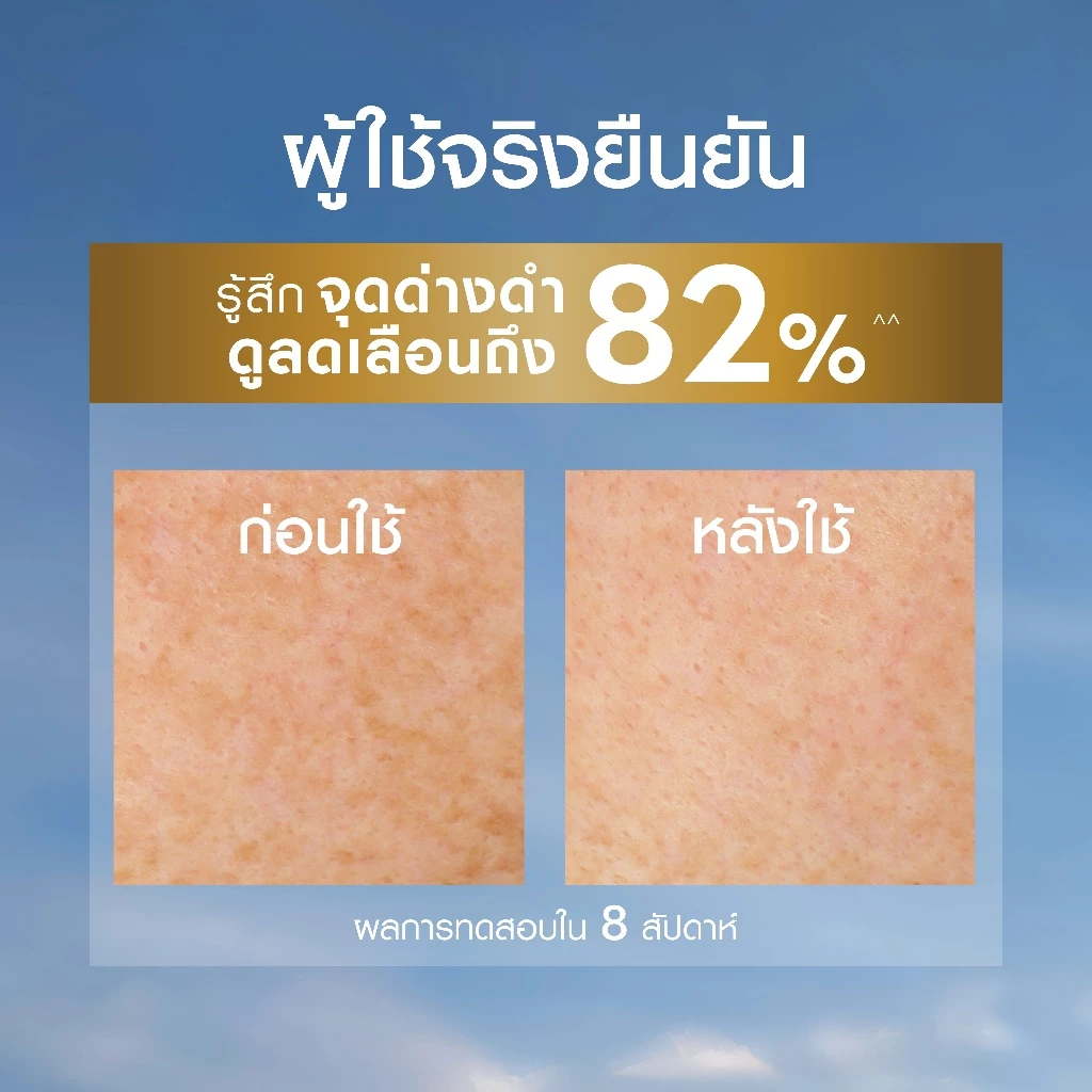นีเวีย ลูมินัส630 แอนตี้สปอต แอนตี้-เอจ แอนด์ สปอต เซรั่ม 30 มล. NIVEA ไทอามิดอล เซรั่มลดริ้วรอย เซรั่ม thumbnail 6