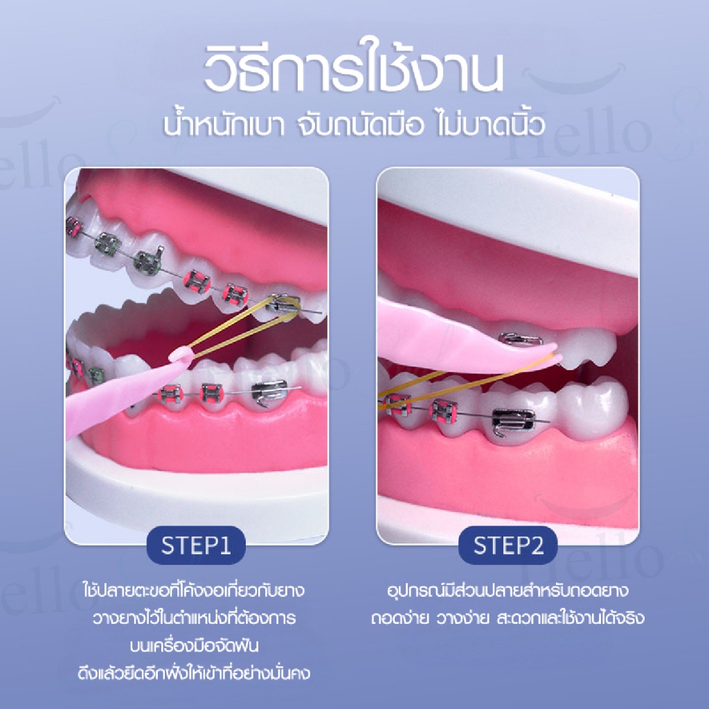 [1แพค5ชิ้น] Hellosmile ตะขอเกี่ยวยาง จัดฟัน ที่ถอดอุปกรณ์จัดฟัน ที่เกี่ยวยาง ช่องปาก ที่ถอด ดึงยาง - รูปที่ 2