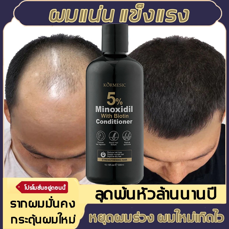 🔥โปรโมชั่น แชมพูปลูกผมสูตรโทนิค แชมพู เซรั่มแฮร์โทนิค  ลดผมร่วงเพิ่มผมหนา เร่งผมยาว